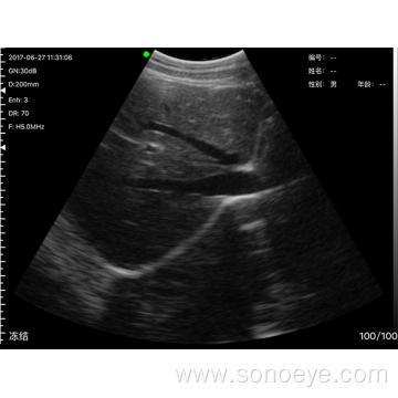 Mini Convex Ultrasound probe